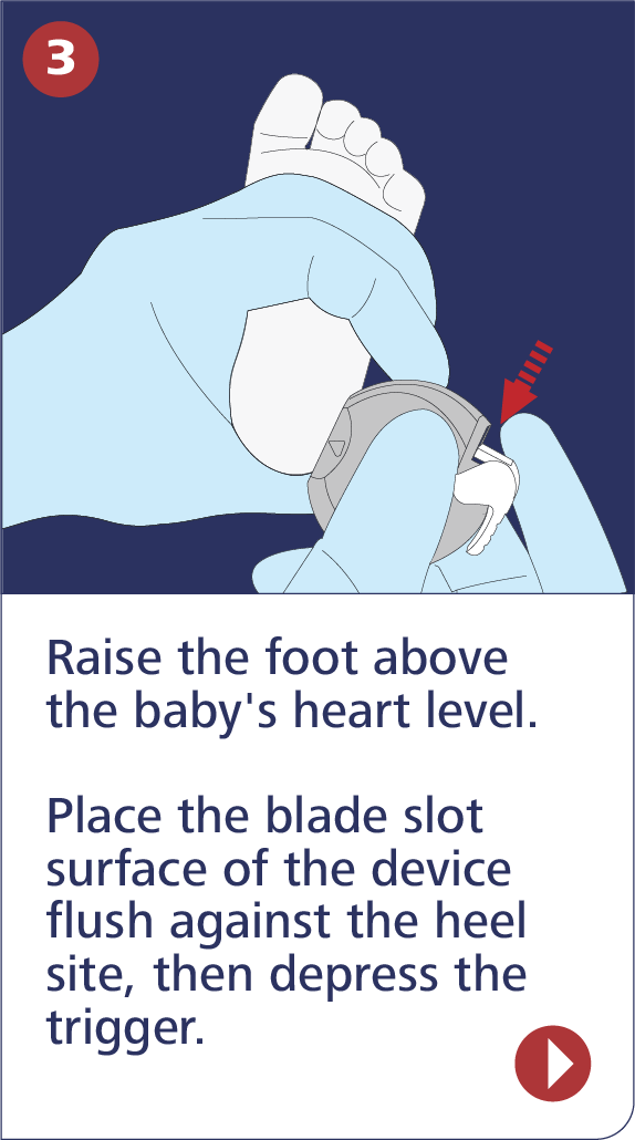 step-3@2x SteriHeel step 3